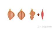 女性私密整形术是什么,重塑自信与美丽的新选择